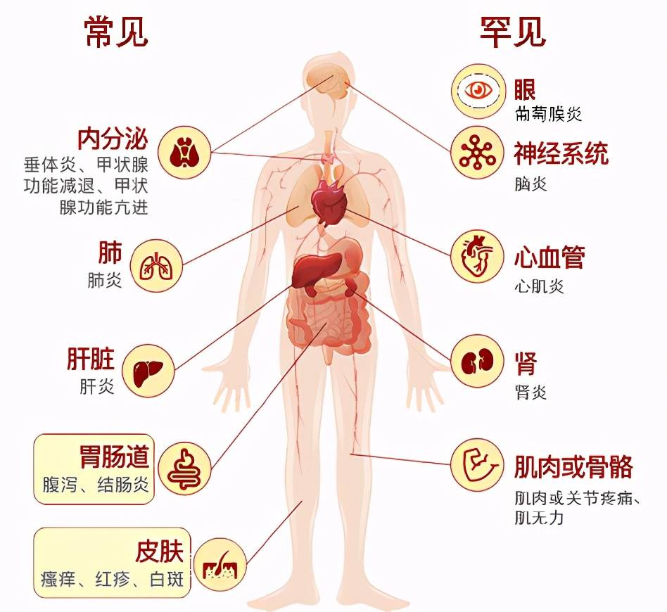 免疫系统疾病症状（免疫治疗相关不良反应管理-罕见篇）(图2)