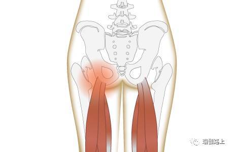 原来臀部疼痛这么严重！该如何缓解？