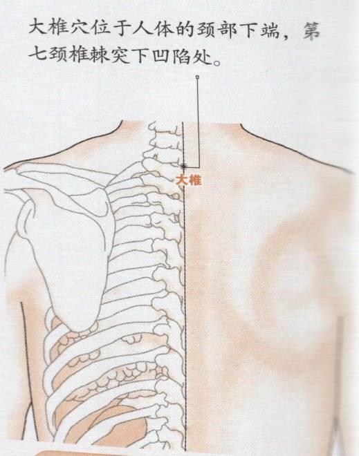 大椎的准确位置图和作用大椎穴位的准确位置图
