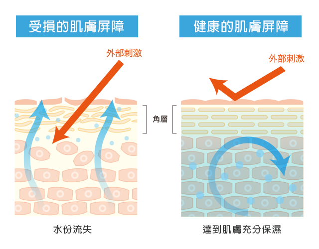 干性皮肤的保养方法