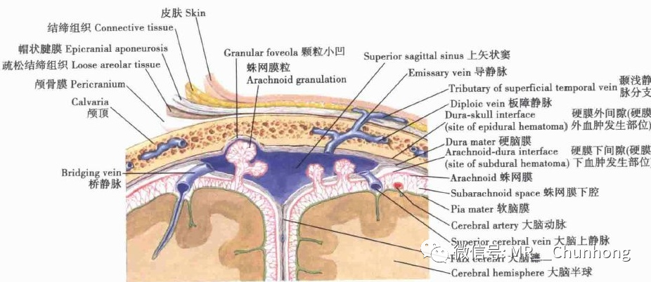 硬膜下间隙图片