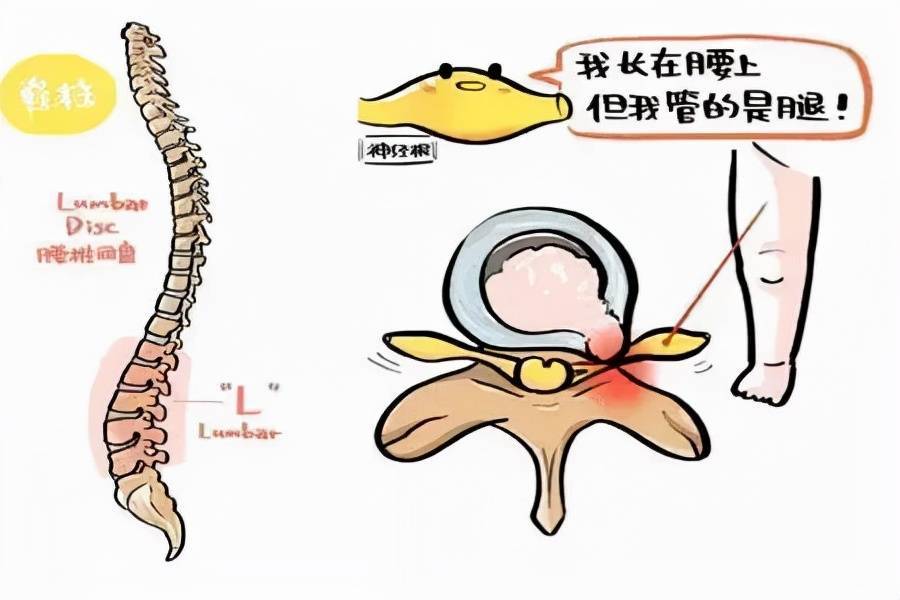 身体这七种“异常”，要警惕是“不死的癌症”强直性脊柱炎