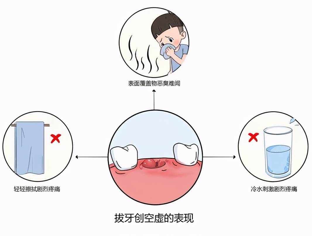 拔完智齒要疼多久拔完智齒第5天還疼正常嗎