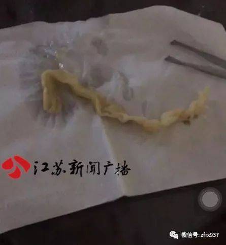 两万块隆个鼻，结果整个世界都变臭了