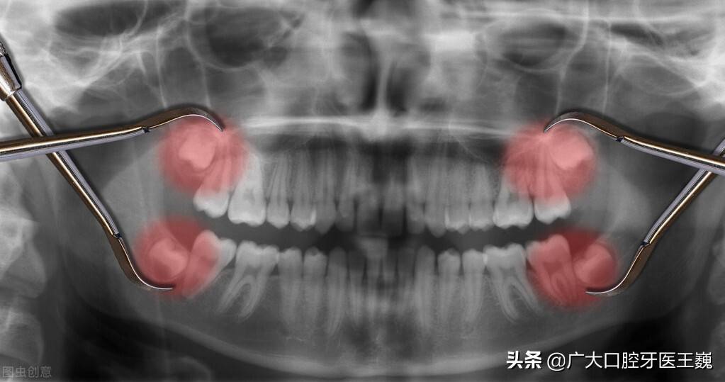 秋季牙龈肿痛怎么回事？知名老牙医给出良方！真的很有效