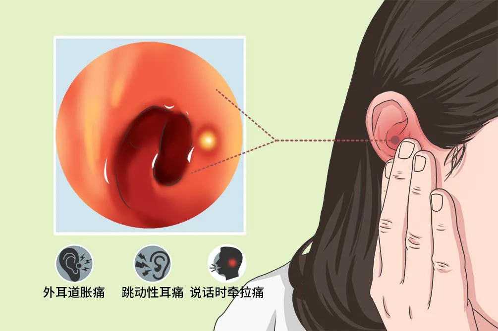 丨耳鼻喉诊室丨耳疖疼痛 针灸显奇效