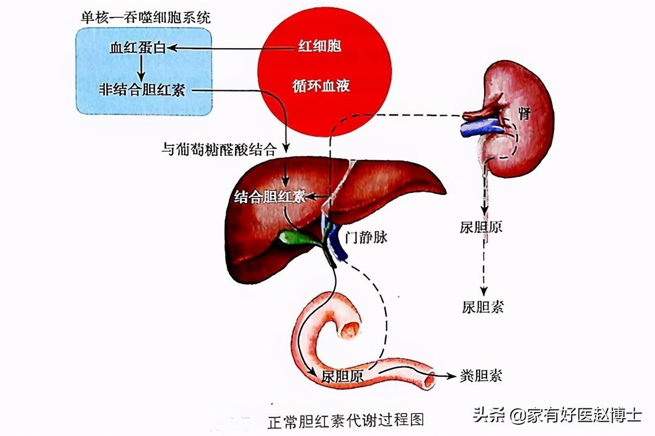 胆红素稍高一点要紧吗，哪些地方找问题？Gilbert综合征是什么？