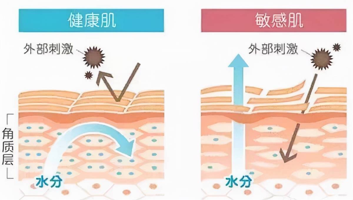 脸上反复过敏发红发痒是什么原因？这4种错误护肤方式赶快改掉