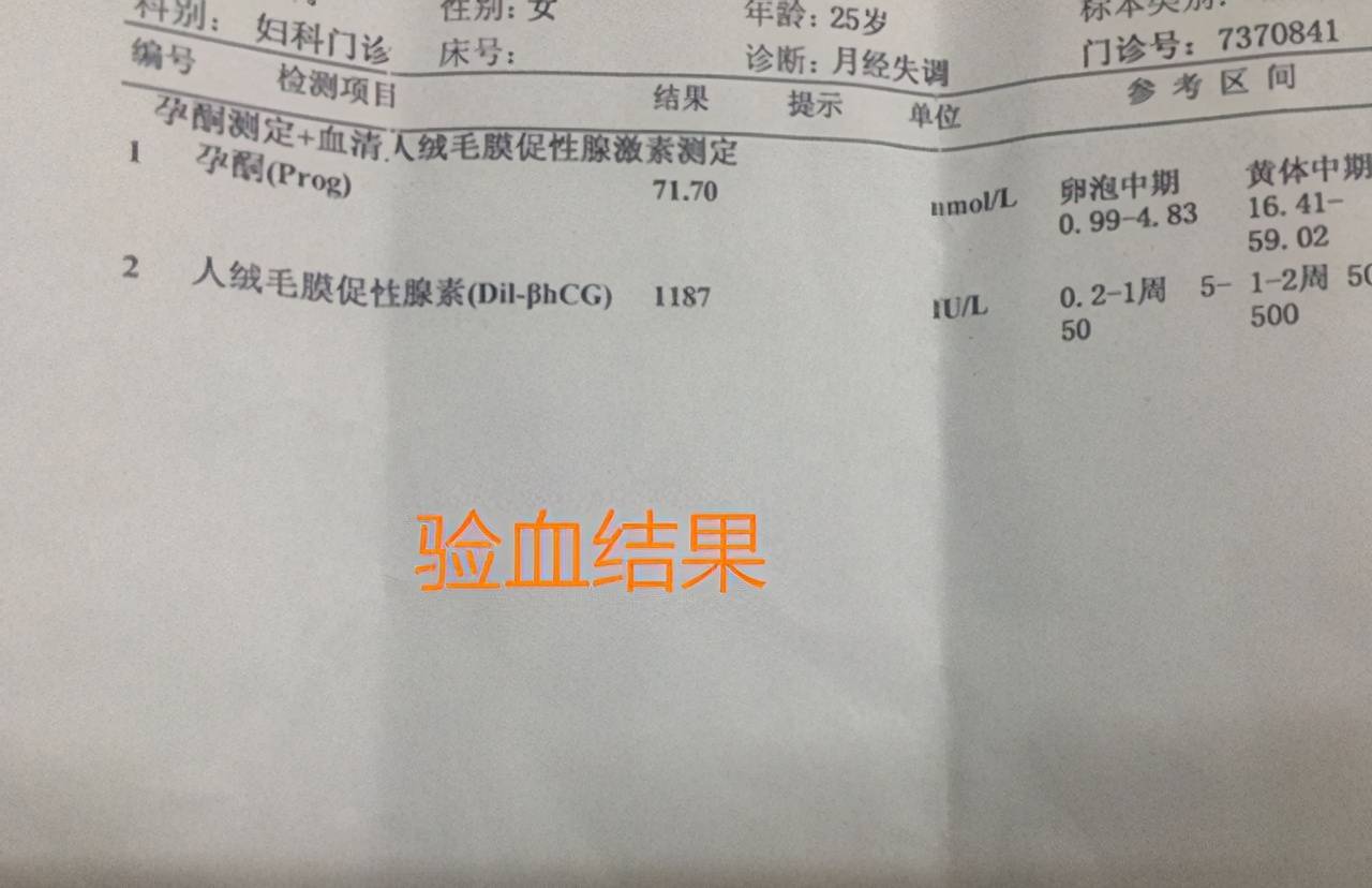 想要确定自己是否怀孕，哪种方式更准确？备孕中的夫妻别大意