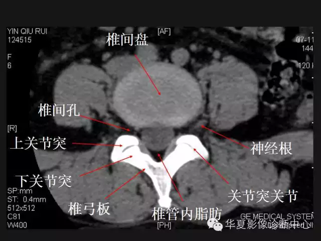 腰椎在哪里腰椎12345节的位置图