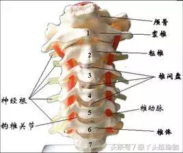 颈椎病轻重程度分十级，看看你是哪一种？