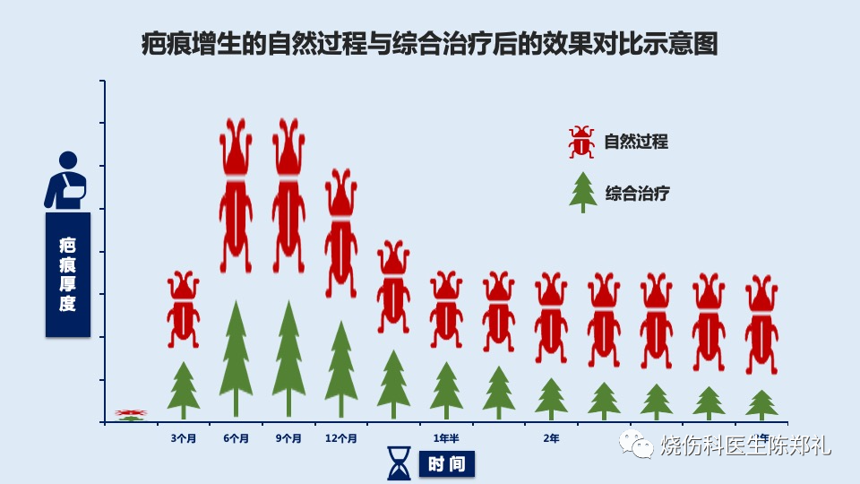 疤痕综合治疗方案（实用干货）